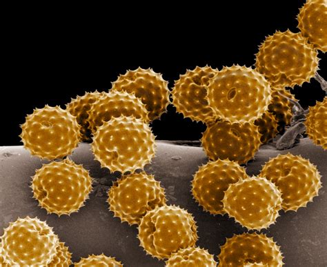 pictures from an electron microscope.
